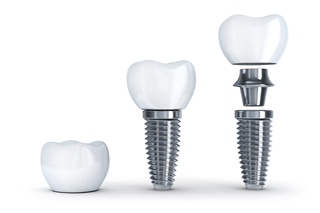 Dental
